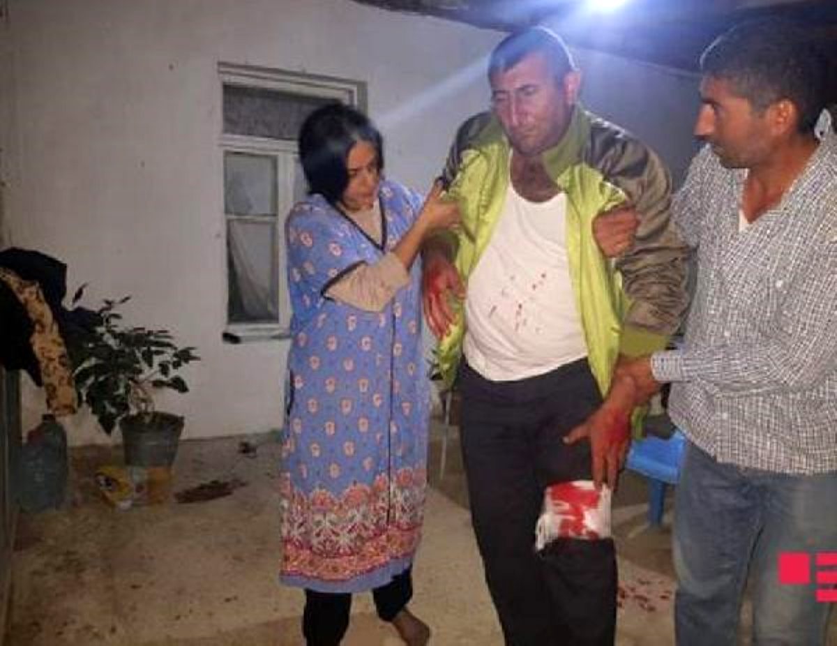 Son dakika! Ermenistan'ın sivillere yönelik yaptığı saldırılarda toplam 19 ölü, 55 kişinin yaralandığı açıklandı